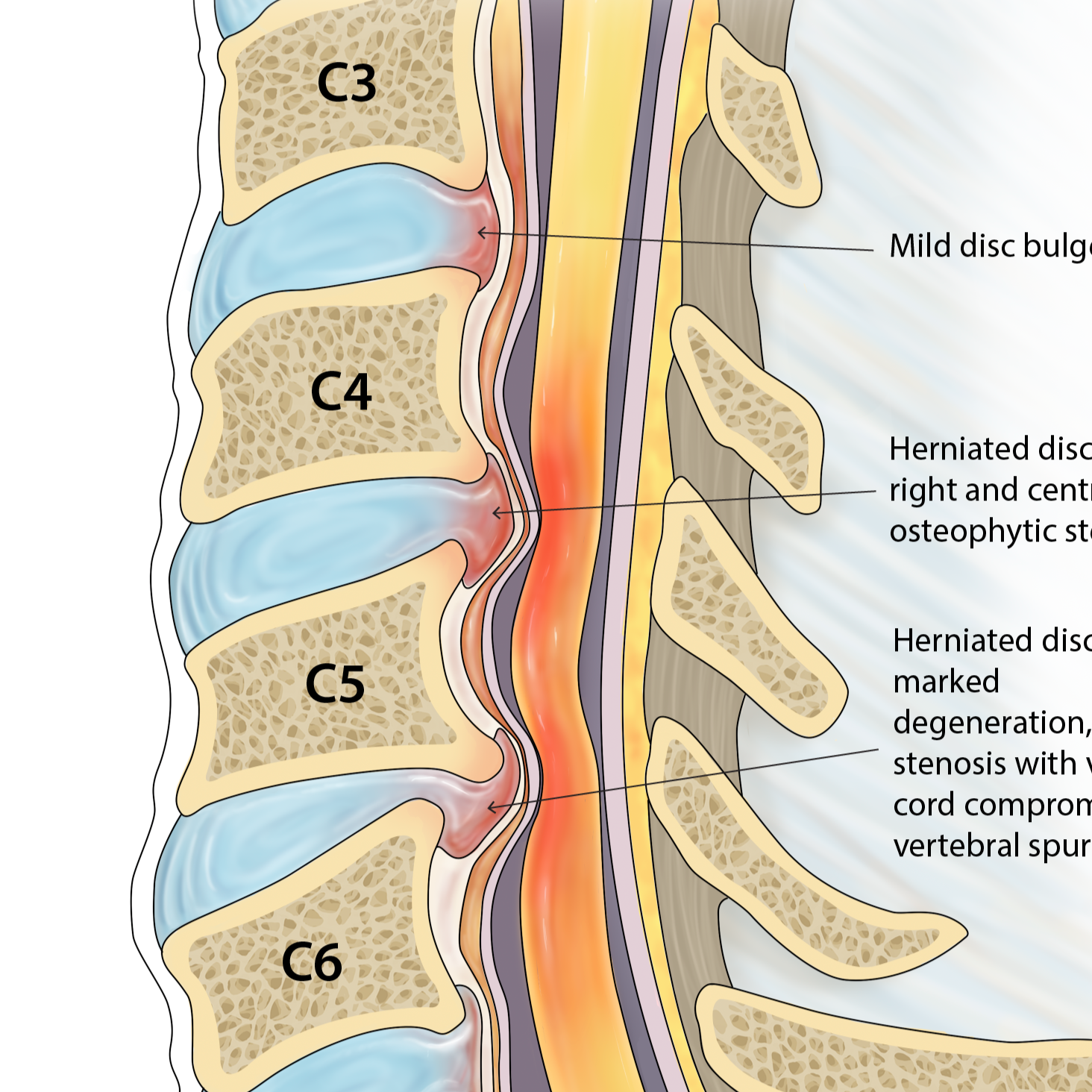 Med legal cervical spine injuries
